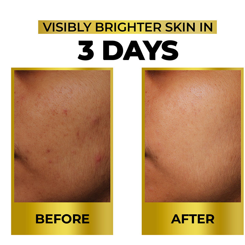 Streax Bright & Shine Face Serum For Brightening, Dark Spots Reduction, 30ml Buy at Indicrest Image 9