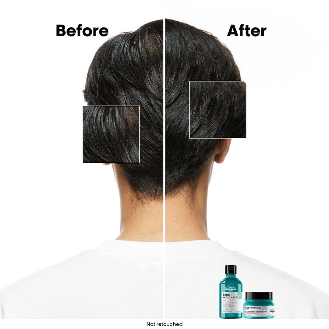 L'Oreal  Professionnel Paris Scalp Advanced Anti-Gras Oiliness Mask, 250ml13