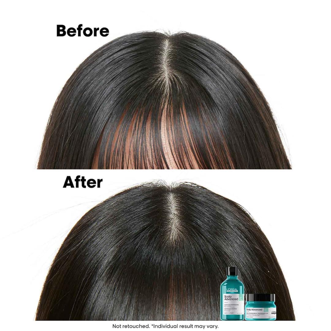 L'Oreal  Professionnel Paris Scalp Advanced Anti-Gras Oiliness Mask, 250ml4